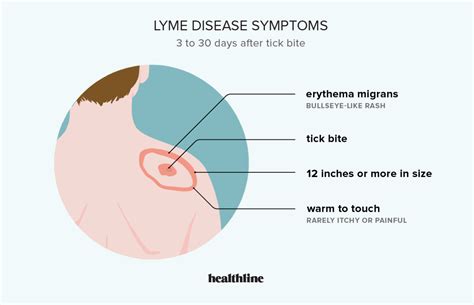 Lyme Disease: Symptoms, Signs, Treatment, and More