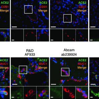 ACE2 protein expression within human vascular endothelial cells and the ...