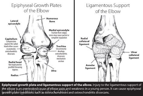 Growth plate injuries