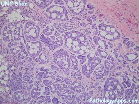 Adenoid Histology