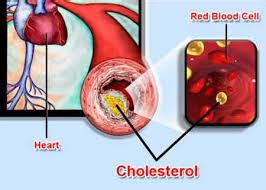 Cholesterol, Heart Disease Risk Factors, & the key to prevention or Rx ...