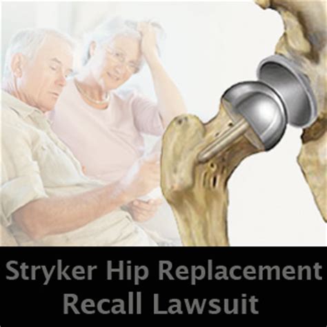 Stryker Rejuvenate Hip Recall Lawsuits Being Investigated by Wright ...