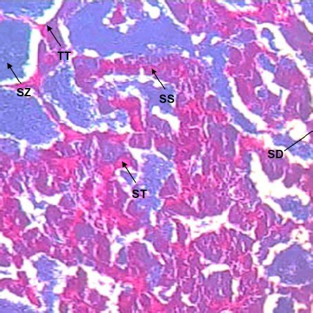 Intersex ZF's gonad histology: TT (testicular tissue); SZ... | Download ...