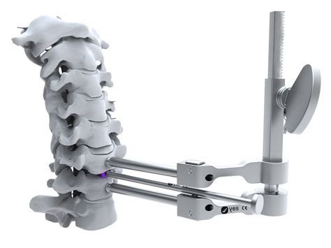 cervical cage product - yellowsteps, spine,stand alone cage