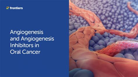 Angiogenesis and Angiogenesis Inhibitors in Oral Cancer | Download ...