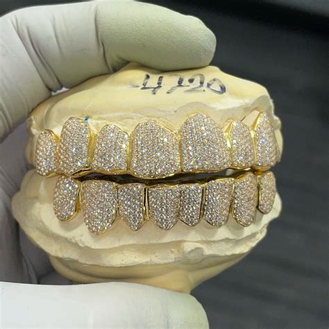 VVS Diamonds Fully Flooded Gold Grillz – Grillz Factory