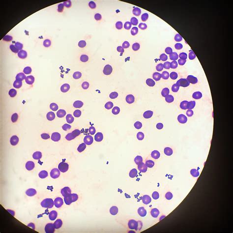 Gram positive cocci in clusters, seen under 100x. : r/medlabprofessionals