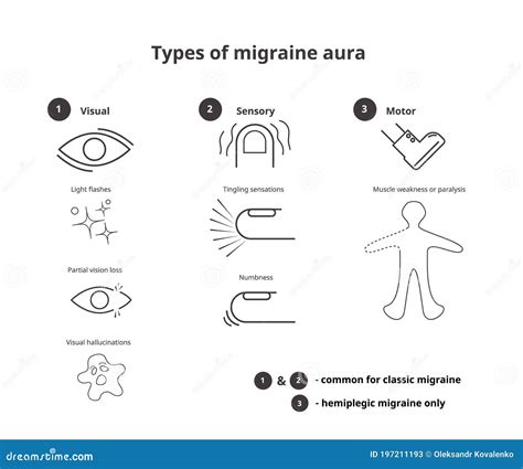 Types of Migraine Aura. Sensory, Visual and Motor Aura of the Classic ...