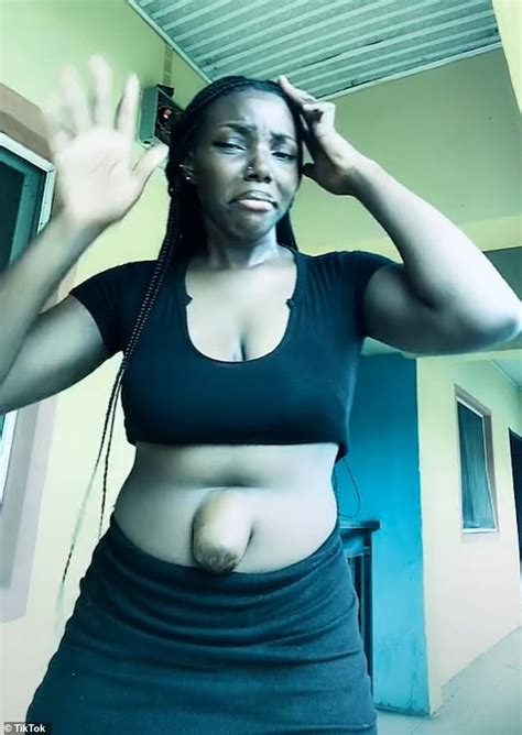 Woman goes viral by showing off her protruding belly button in crop ...