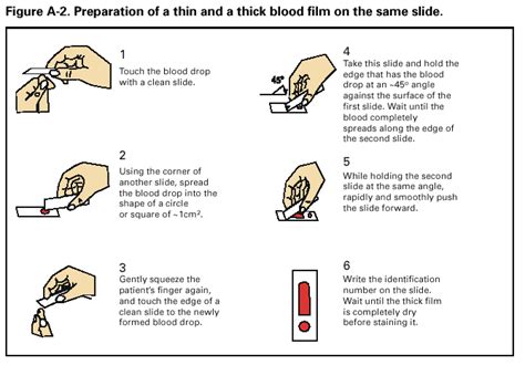 APPENDIX: Microscopic Procedures for Diagnosing Malaria