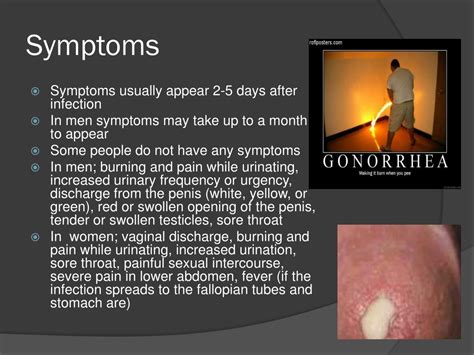 Gonorrhea symptoms men - milomister