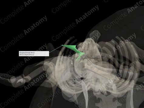 Iliopectineal Arch (Left) | Complete Anatomy