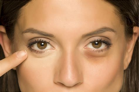 Learn How to Get Rid of Eye Bags | ReadingGlasses.com