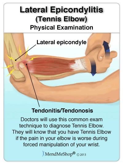 Best Brace for Tennis Elbow | Tennis elbow, Tennis elbow brace and ...