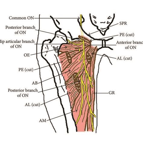 (PDF) Ultrasound-Guided Obturator Nerve Block: A Focused Review on ...