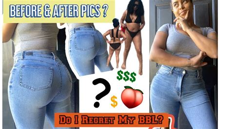 BBL BEFORE & AFTER PICS! | DO I REGRET MY BBL!? | PRE OP INFO - YouTube