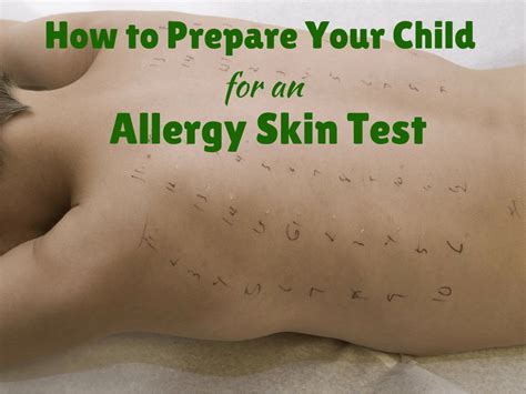 How to Prepare Your Child for an Allergy Skin Test