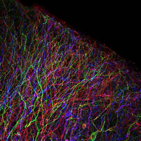 All the Colors of the Brainbow | 50um vibratome section from… | Flickr