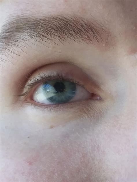 The amount of detail in my prosthetic eye is pretty neat https://ift.tt/2Tnu7RI | Prosthetics ...