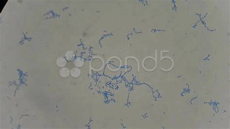 Strep Throat Bacteria Microscope