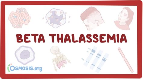 Beta-thalassemia - causes, symptoms, diagnosis, treatment, pathology ...