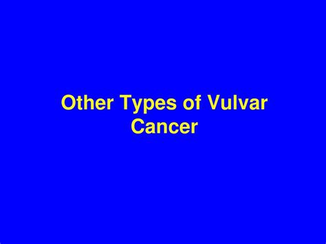 PPT - Vulvar Cancer PowerPoint Presentation, free download - ID:227179