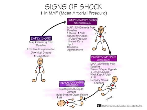 signs of shock | Nursing mnemonics, Nursing school survival, Nurse