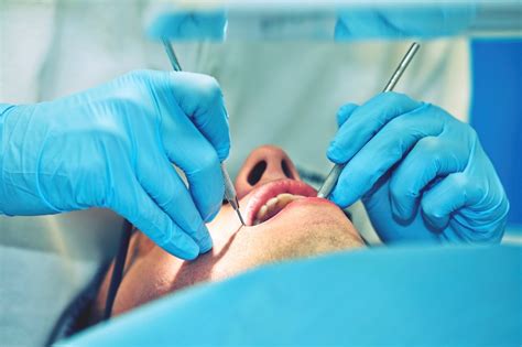 Solace Oral Surgery: What Is an Apicoectomy and How Is It Performed?