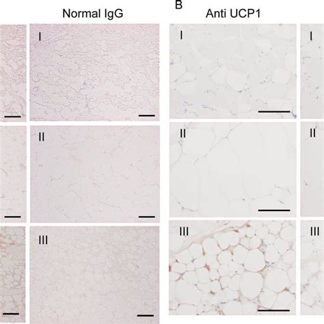 Immunohistochemical analysis of dolphin blubber. Sections of blubber... | Download Scientific ...