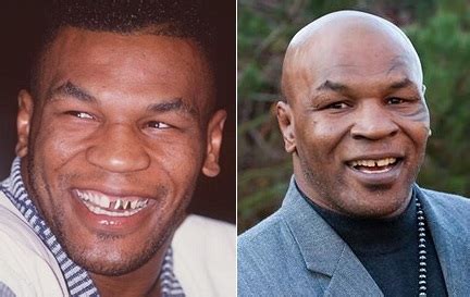 Mike Tyson Gap