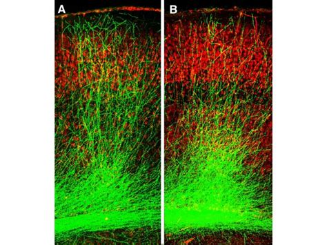 Schizophrenia Model Shows Stun [IMAGE] | EurekAlert! Science News Releases