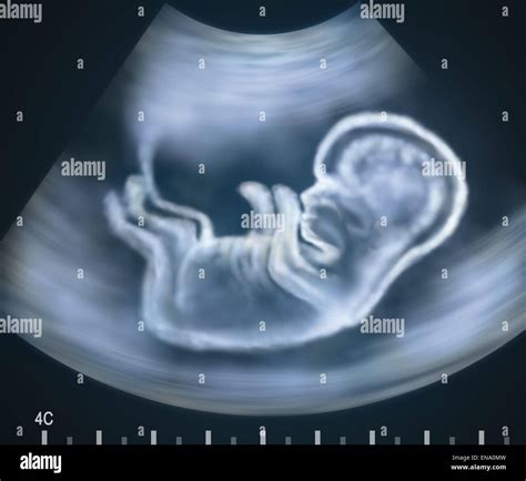 Ultrasound image of baby in mother's womb. Concept Stock Photo - Alamy