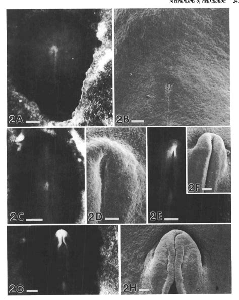 Figure 1 from Mechanisms of neurulation: traditional viewpoint and ...