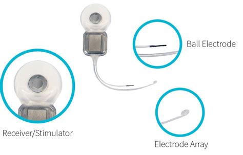 Parts Of A Cochlear Implant