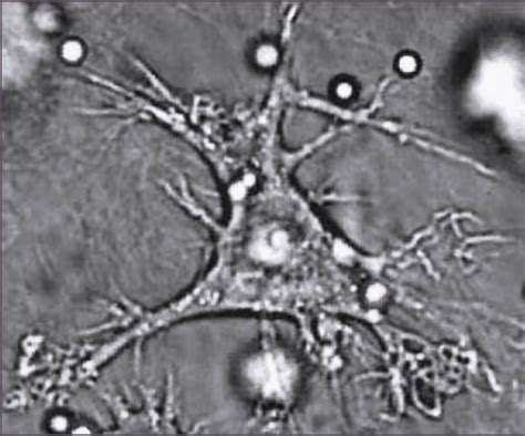 11.9A: Dendritic Cells - Biology LibreTexts