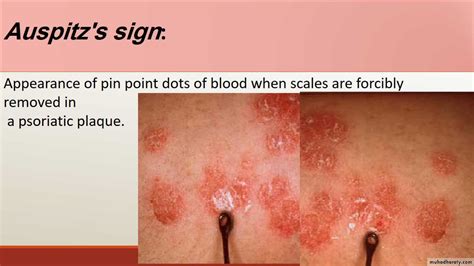 Diagnosis of Skin Diseases pptx - D. Hadf - Muhadharaty