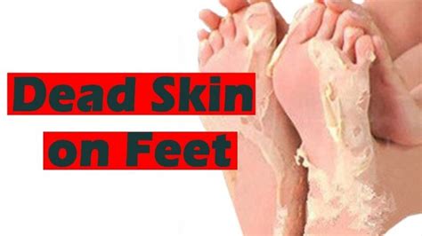 Best Way To Remove Dead Skin From Feet [ Top 5 Ways ]