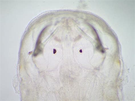 Spadella cephaloptera (Busch, 1851) - An Arrow worm (Chaetognatha images)