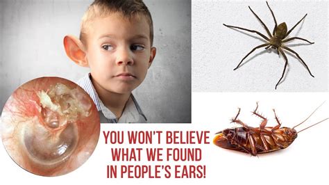 You won't believe what we found in people's ears! | Bug in ear symptoms