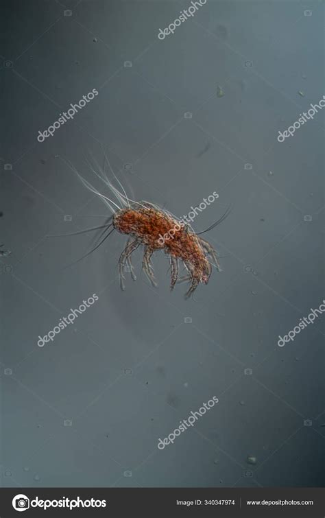 House Dust Mites Microscope 100X — Stock Photo © PantherMediaSeller #340347974