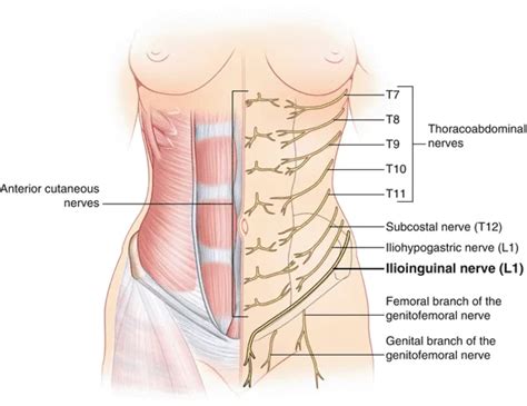 Iliohypogastric Nerve Distribution