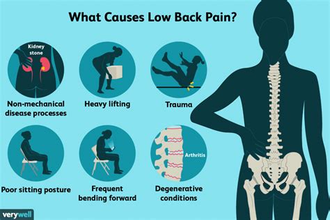 Sciatica | Lumbar Disc | Back Pain Treatment | The Pain Relief Practice