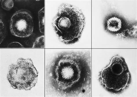 Electron micrographs of herpes viruses | Biology of Human/World of Viruses