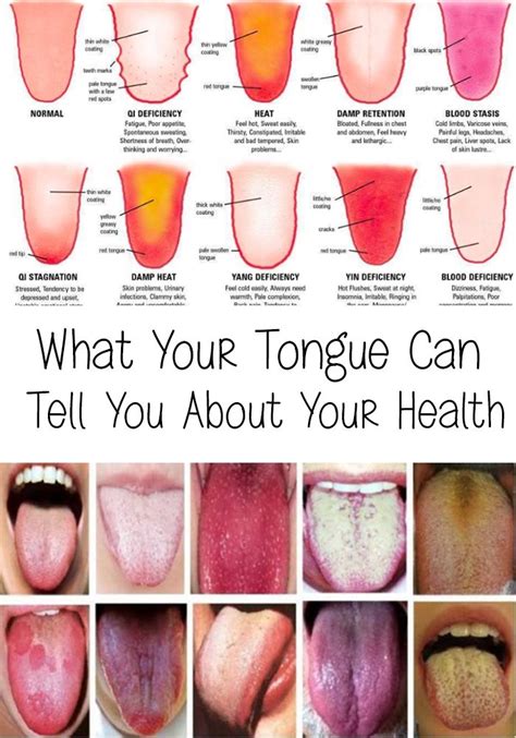 Tongue - What Your Tongue Can Tell You About Your Health | Tongue health, Healthy tongue, Health ...