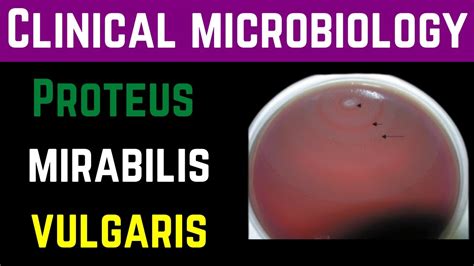 Proteus Mirabilis & Vulgaris Clinical,Pathogenesis,Investigation ...