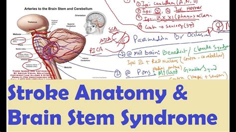 Brainstem Syndromes