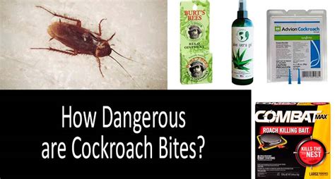 Cockroach Bites: You'd Better Be Careful! Symptoms, First Aid, Prevention