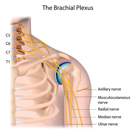 Top Homeopathic Medicines For Brachial Neuritis - Homeopathy at DrHomeo.com