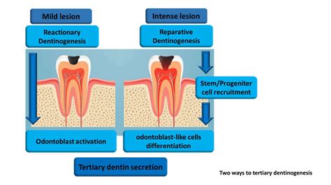 Dentin regeneration based on tooth tissue engineering: A review | PPT