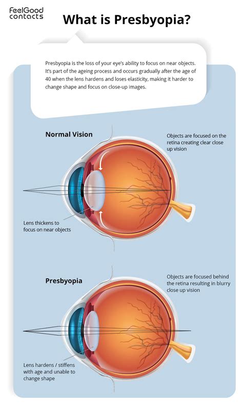 Why is presbyopia? | Feel Good Contacts